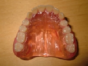 curso de tecnico em protese dentaria