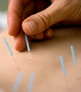Mal de parkinson tratamento acupuntura Massagem